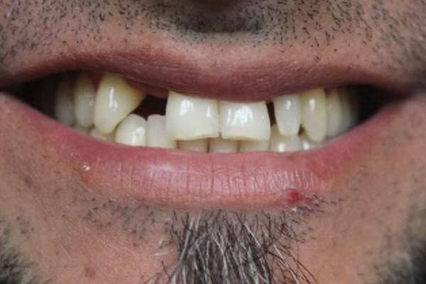 After-Ortho-Perio