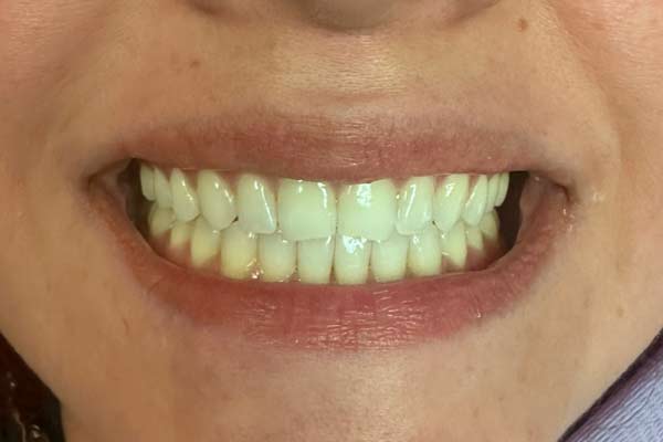 After-closing-gap