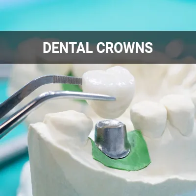 dental crowns tooth restoration treatment