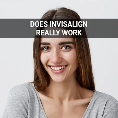 does invisalign really work aligners treatment