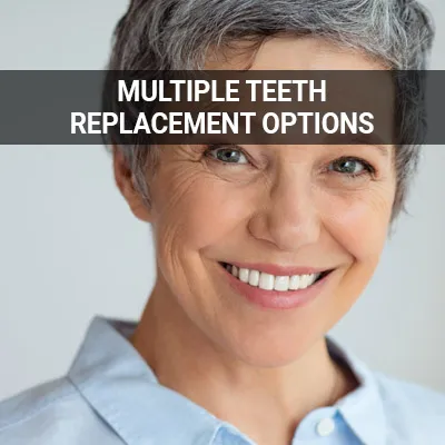 multiple teeth replacement options implants dentures