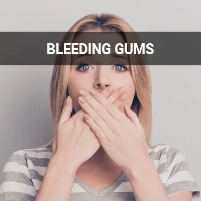 why are gums bleeding dental problem